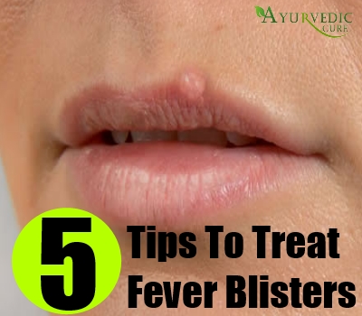 Cure Fever Blister